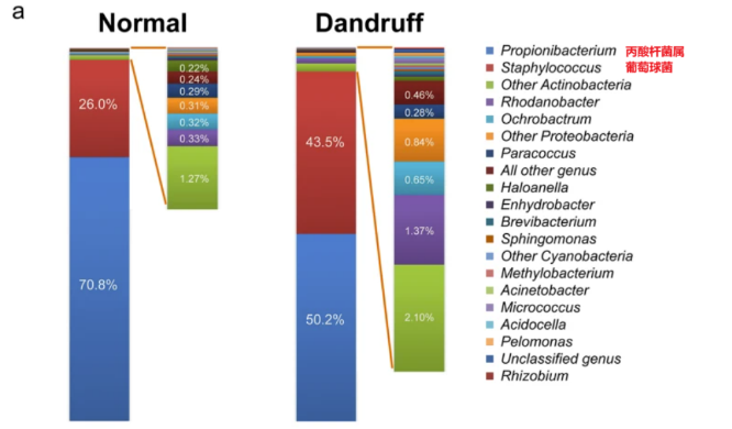 頭皮,健康,頭皮脫屑,頭皮皮脂