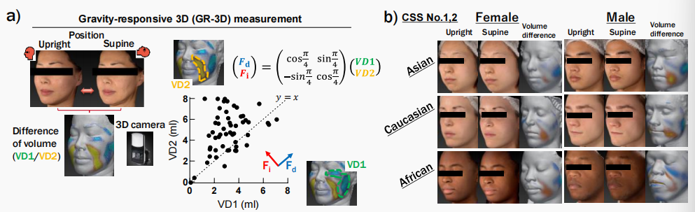 CIRS功效評價,技術(shù)實踐,下垂,水腫,定量評估