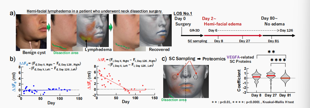 CIRS功效評價,技術(shù)實踐,下垂,水腫,定量評估