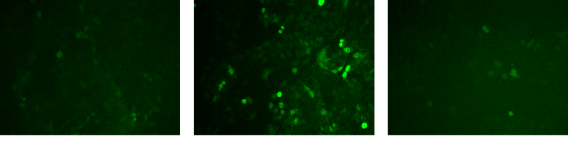 化妝品,抗氧化,抗衰,氧化還原反應,皮膚,ROS