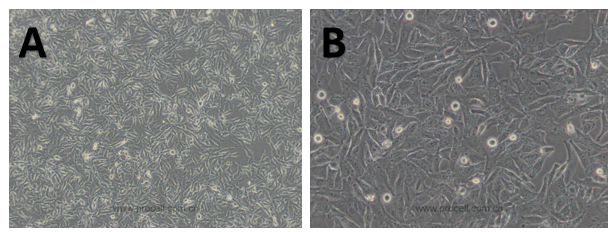 體外細(xì)胞,培養(yǎng),模型,祛斑,美白,功效評(píng)估